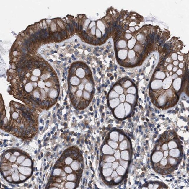 Anti-TRIP4 antibody produced in rabbit