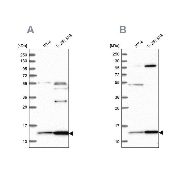 Anti-TRMT112 antibody produced in rabbit