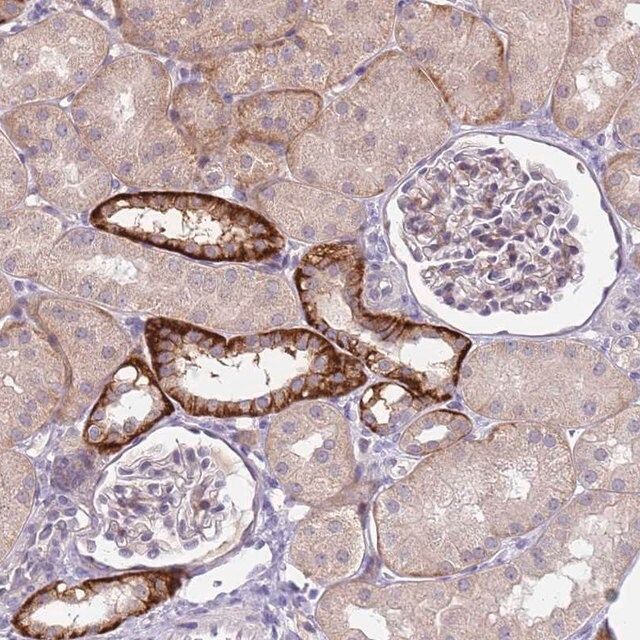 Anti-TRMT10A antibody produced in rabbit