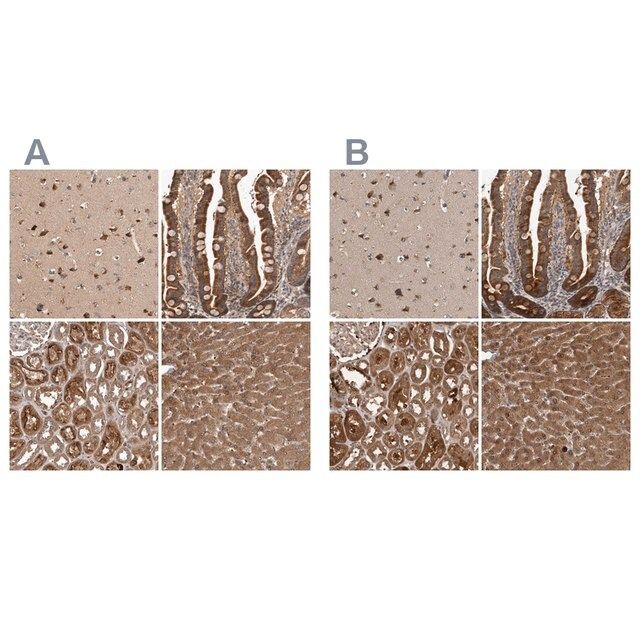 Anti-TRMT61B antibody produced in rabbit