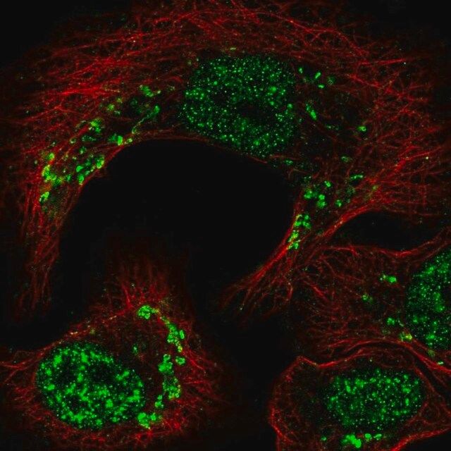 Anti-TRIP11 antibody produced in rabbit