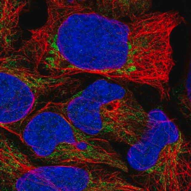 Anti-TRMU antibody produced in rabbit