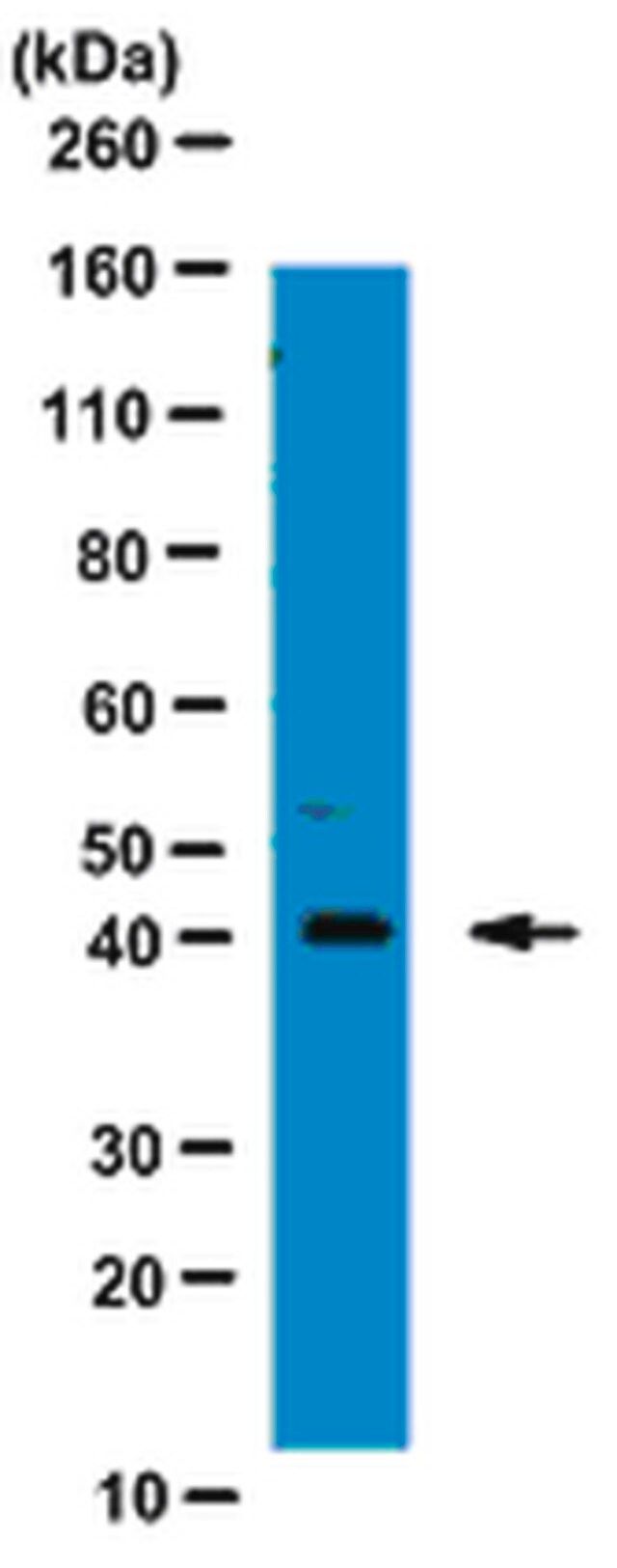 Anti-Tristetraprolin Antibody