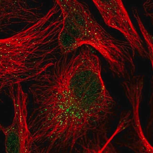 Anti-TRIP10 antibody produced in rabbit