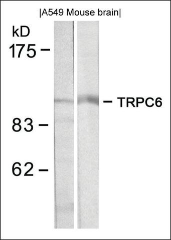 Anti-TRPC6 antibody produced in rabbit