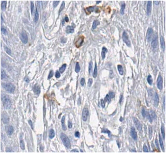 Anti-TRP1/TYRP1 Antibody, clone TA99, Azide Free