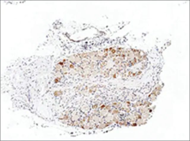 Anti-TRPA1 antibody produced in rabbit