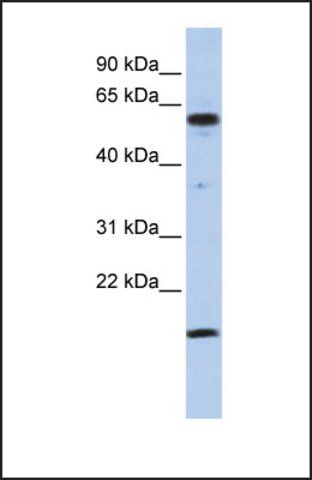 Anti-TRIP10 antibody produced in rabbit