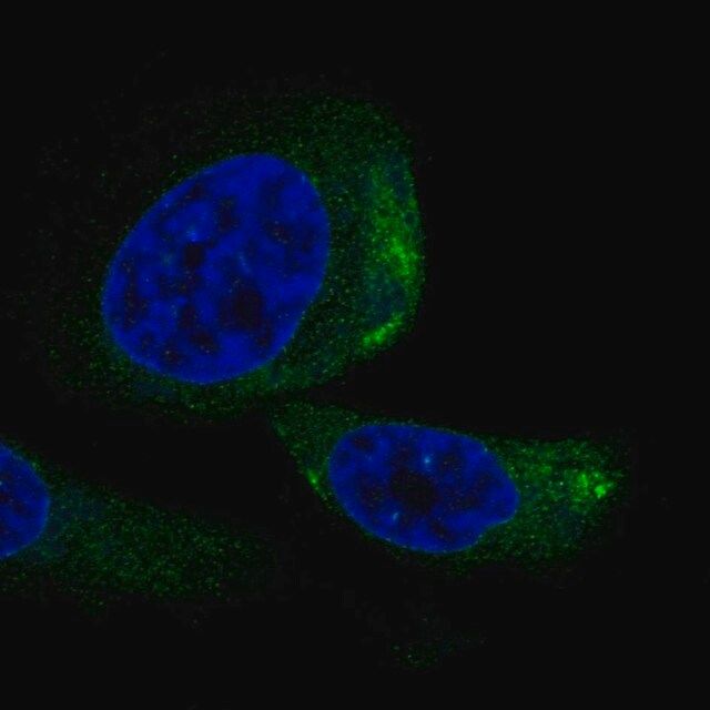 Anti-TRIQK antibody produced in rabbit