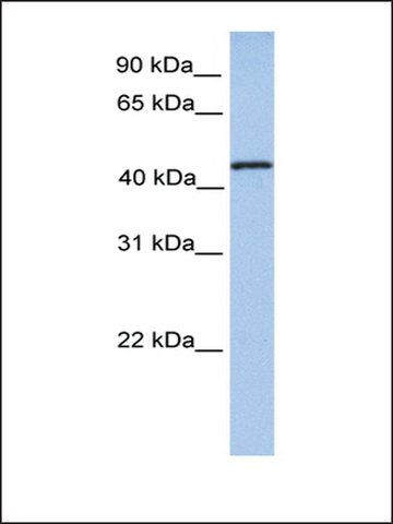 Anti-TRMT11 antibody produced in rabbit