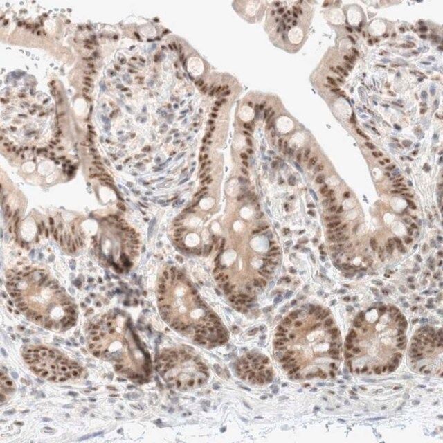 Anti-TRMT12 antibody produced in rabbit