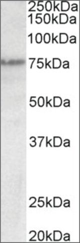 Anti-Trp63 (C OR N-TERMINAL) antibody produced in goat