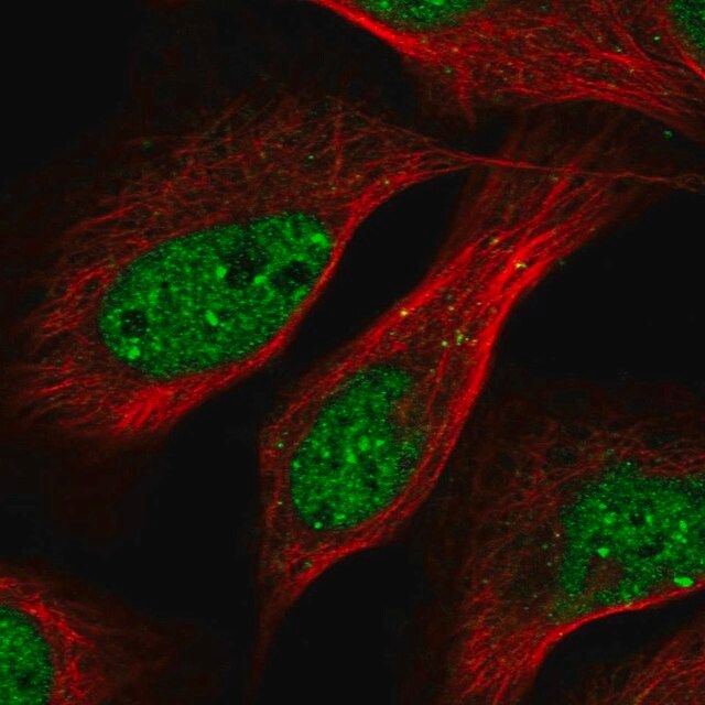 Anti-TRIP4 antibody produced in rabbit