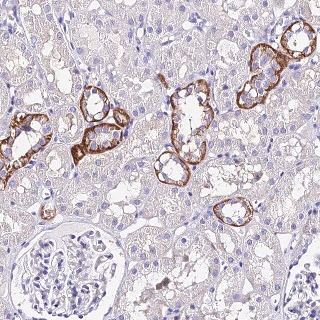 Anti-TRMT44 antibody produced in rabbit