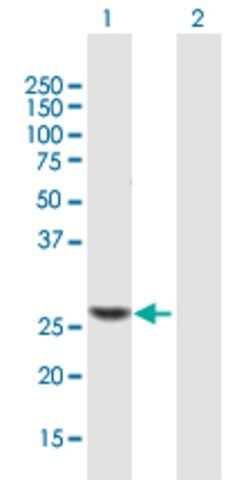 ANTI-TRMU antibody produced in mouse