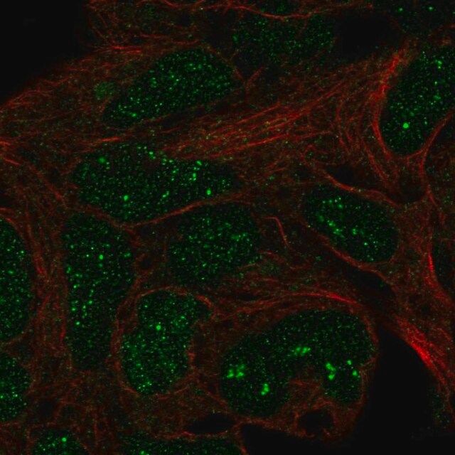 Anti-TRMT11 antibody produced in rabbit