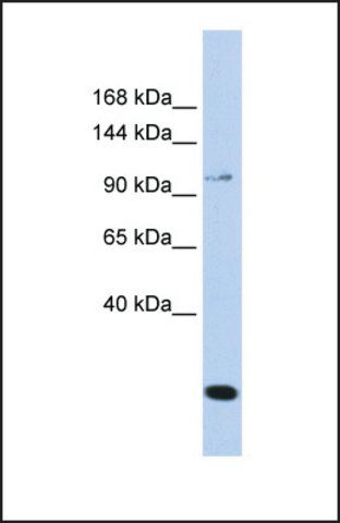 Anti-TRPC6, (N-terminal) antibody produced in rabbit