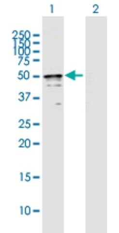 Anti-TRMT2B antibody produced in mouse