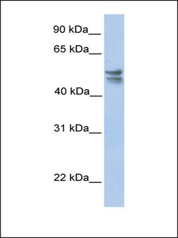 Anti-TRMU antibody produced in rabbit