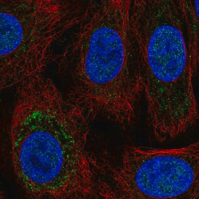 Anti-TRPC6 antibody produced in rabbit