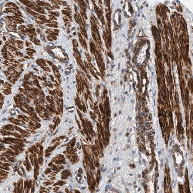 Anti-TMEM70 antibody produced in rabbit