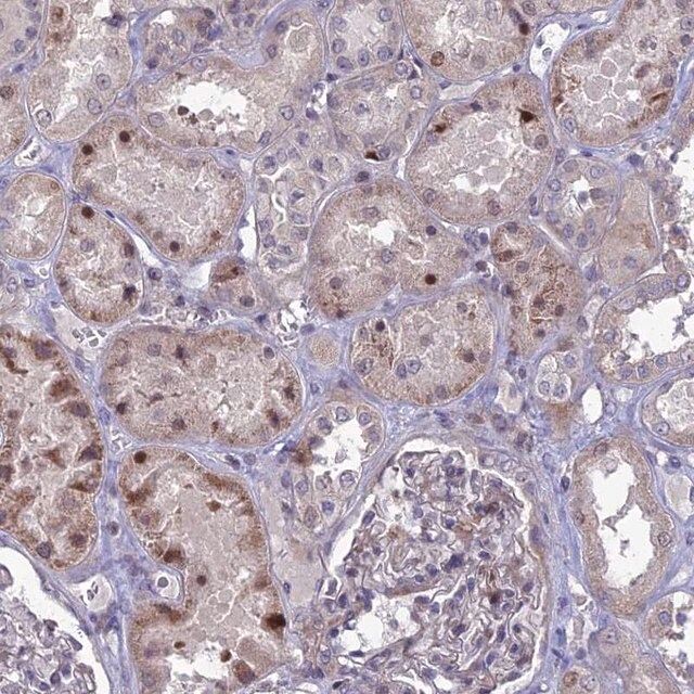 Anti-TMEM263 antibody produced in rabbit