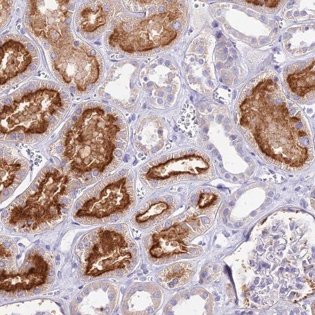 Anti-TMEM78 antibody produced in rabbit