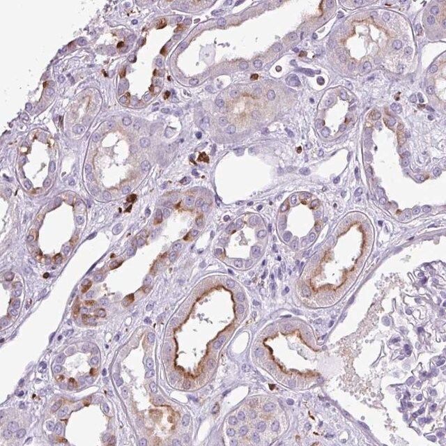 Anti-TMEM200C antibody produced in rabbit