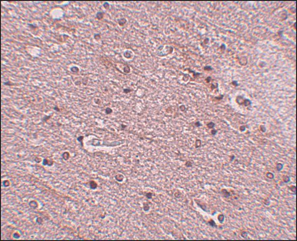 Anti-TMEM16B antibody produced in rabbit