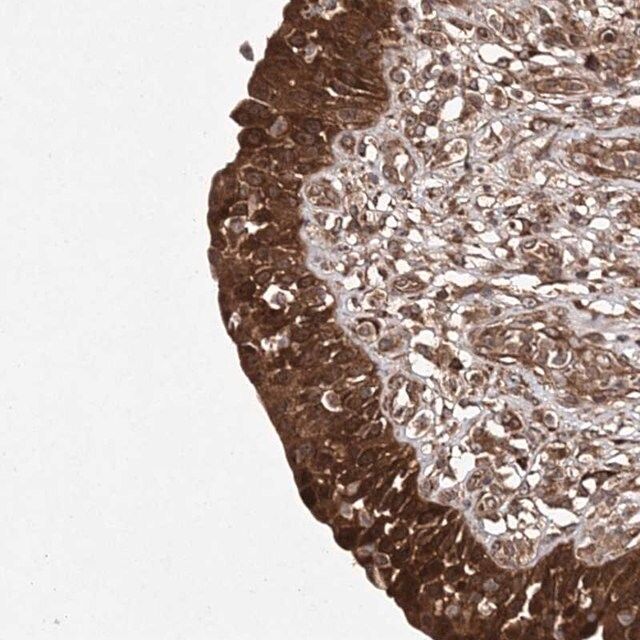 Anti-TMEM9B antibody produced in rabbit