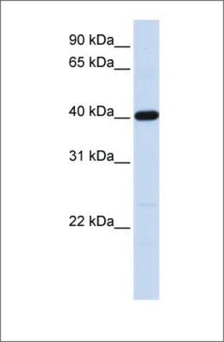 Anti-TMOD3 (ab2) antibody produced in rabbit