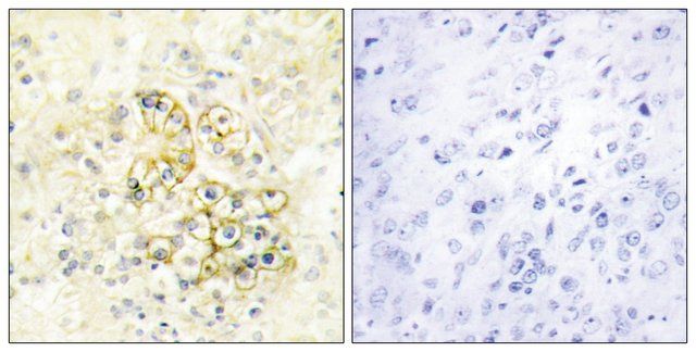 Anti-TMEPA antibody produced in rabbit