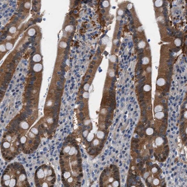 Anti-TMEM45B antibody produced in rabbit