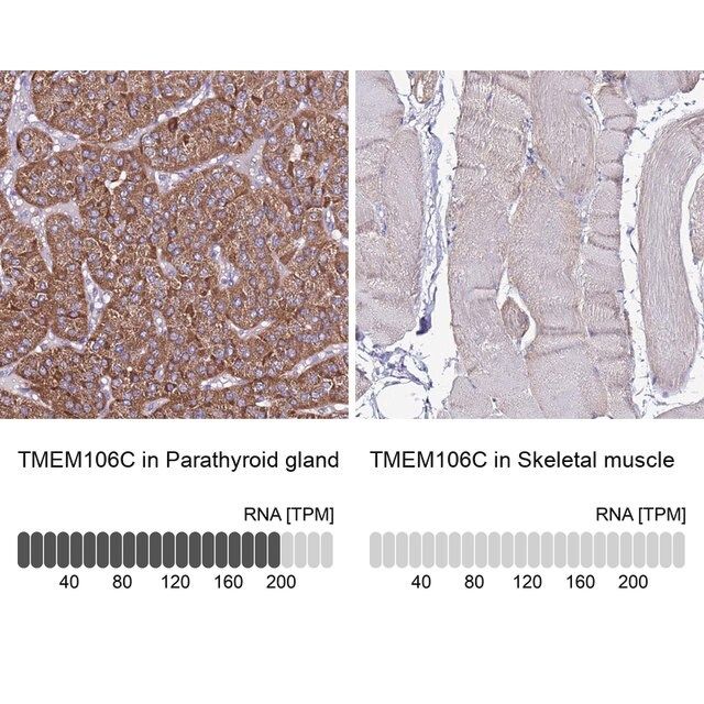 Anti-TMEM106C antibody produced in rabbit