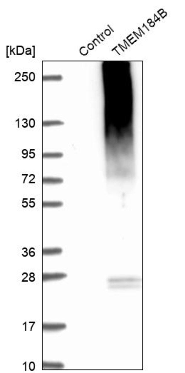 Anti-TMEM184B antibody produced in rabbit