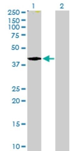 Anti-TMOD2 antibody produced in mouse