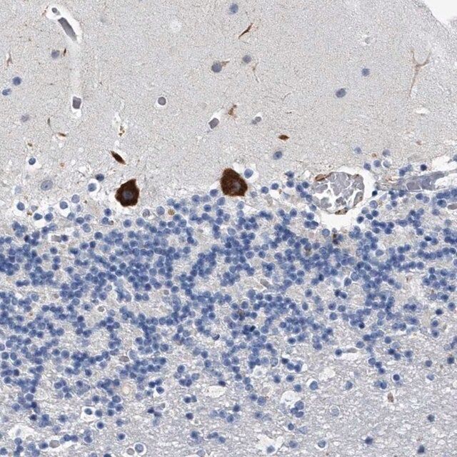 Anti-TMEM63C antibody produced in rabbit