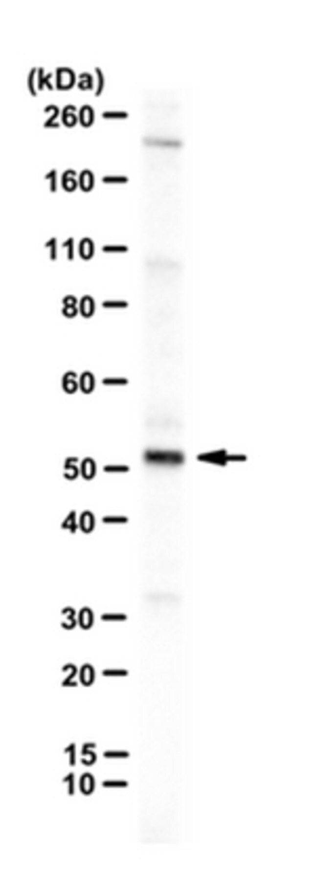 Anti-TMIGD1 Antibody