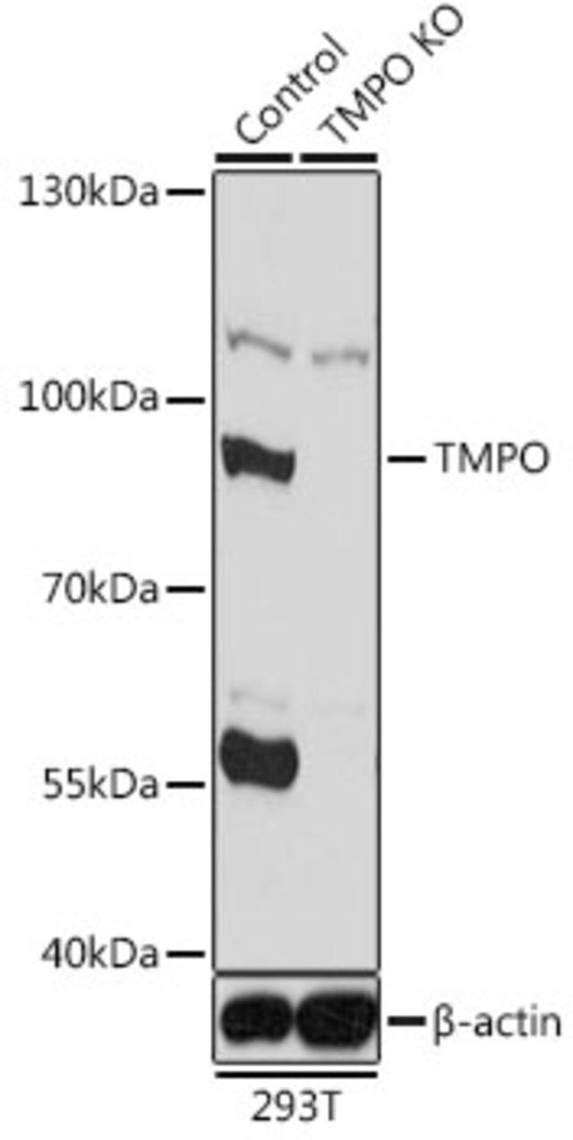 Anti-TMPO antibody produced in rabbit