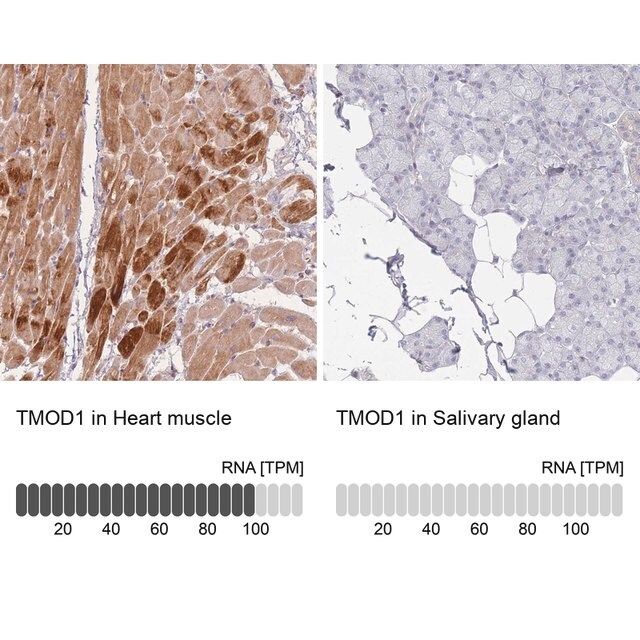 Anti-TMOD1 antibody produced in rabbit