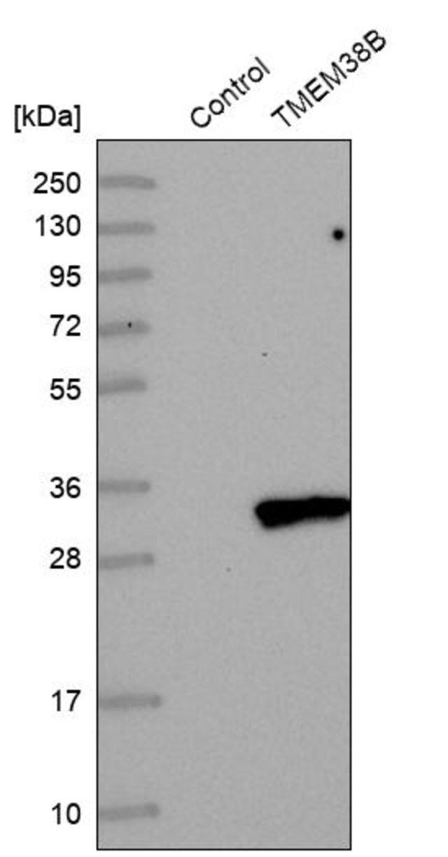 Anti-TMEM38B antibody produced in rabbit