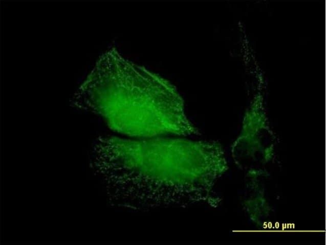 Anti-TMOD1 antibody produced in mouse