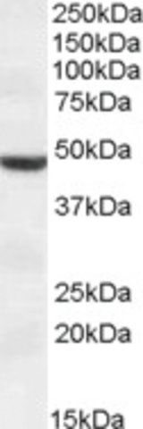 Anti-TMPRSS4 antibody produced in goat