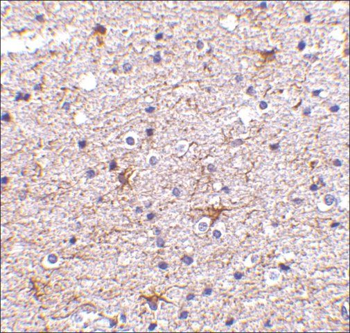 Anti-TMP21 (ab1) antibody produced in rabbit