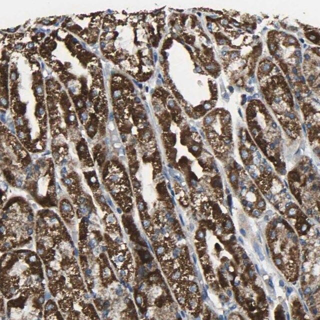 Anti-TMEM120B antibody produced in rabbit