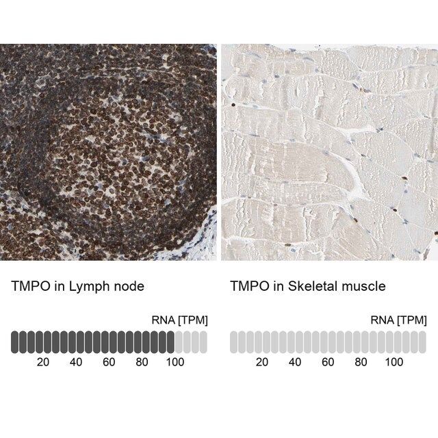 Anti-TMPO antibody produced in rabbit