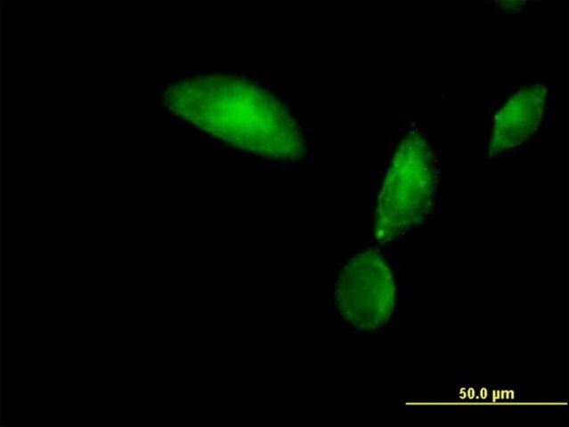 Anti-TMOD3 antibody produced in mouse