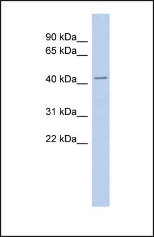 Anti-TMPO antibody produced in rabbit