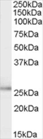 Anti-TPD52L1/D53 antibody produced in goat