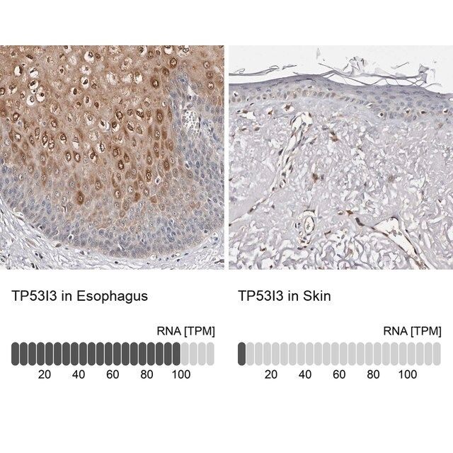 Anti-TP53I3 antibody produced in rabbit